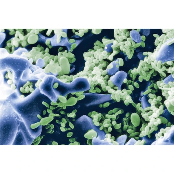 Sera Pond Siporax 2kg (10l) 4 Sera Pond Siporax 2kg (10l) – Bild 2